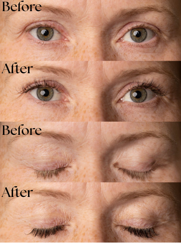 ZoraniGlow™ Wimperserum Vegan